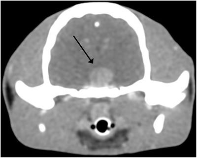 Case Report: Cytologic Description of Somatotroph Pituitary Adenoma in a Cat